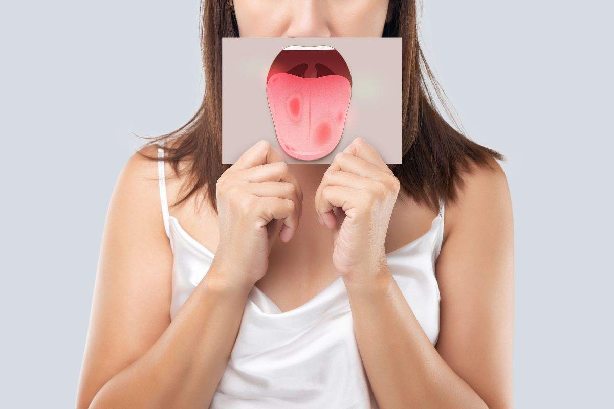 sintomi lingua malattie