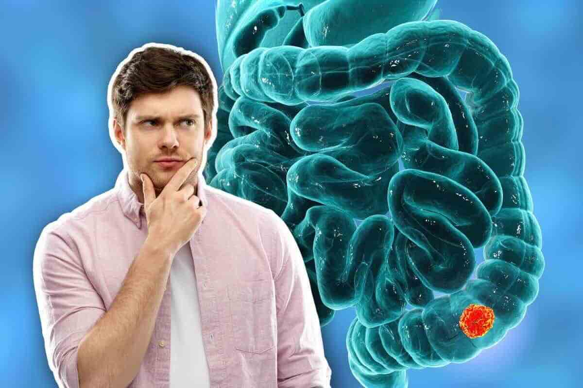 sintomi e prevenzione tumore al colon