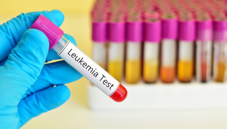 Leucemia, il sintomo più ignorato