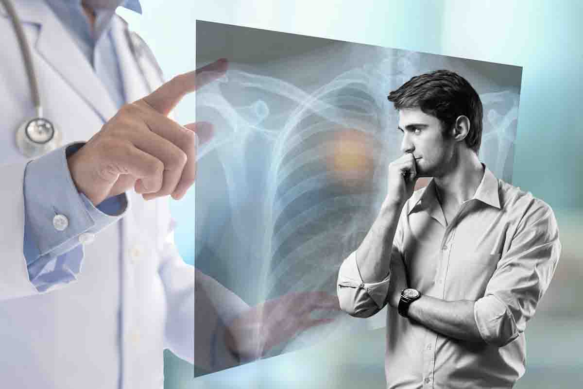 Come si può sopravvivere al tumore ai polmoni