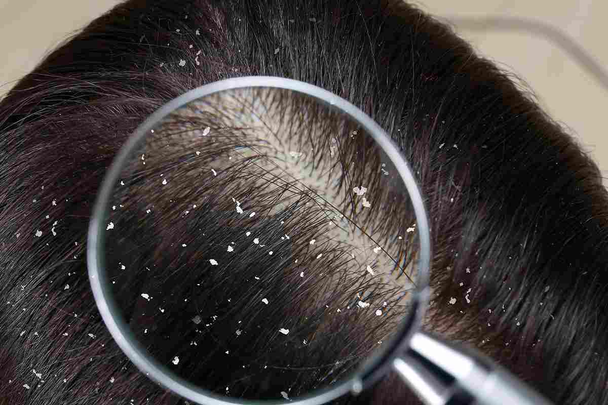 Forfora capelli